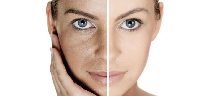 до і після омолодження шкіри обличчя