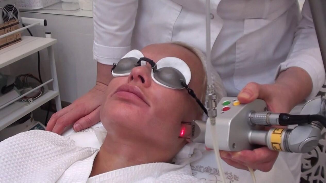 Обробка лазерним променем проблемних ділянок шкіри обличчя